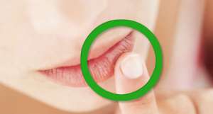 Niedobór witamin w organizmie- najczęstsze objawy