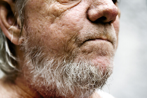 Broda pełna siwych włosów