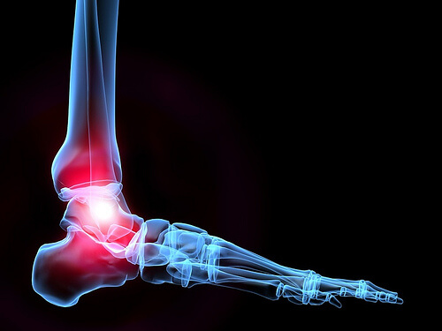 Osteoporoza