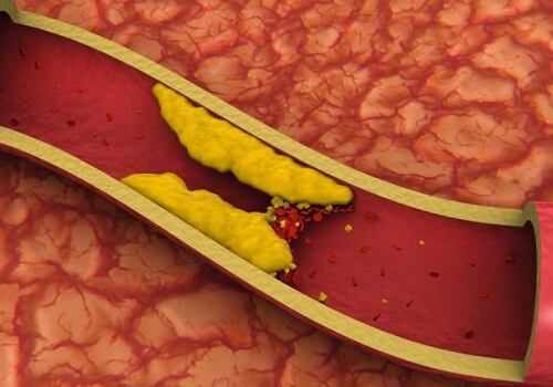 Soki obniżające poziom cholesterolu – przepisy