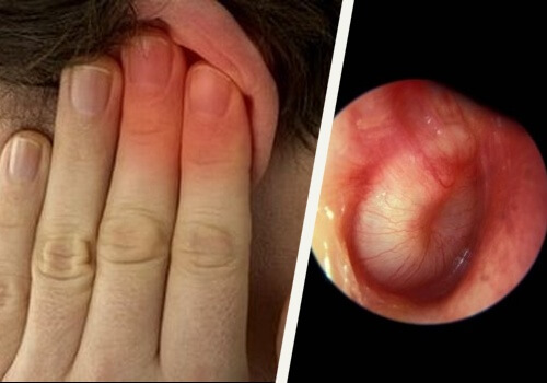 Co robić, gdy uszy dopada infekcja?