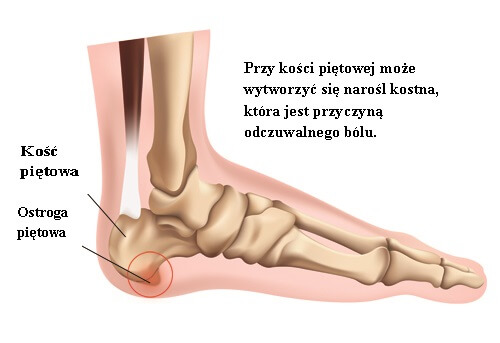 Ostroga piętowa