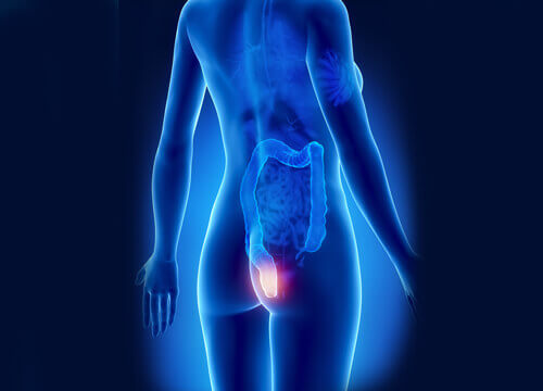 Lokalizacja hemoroidów