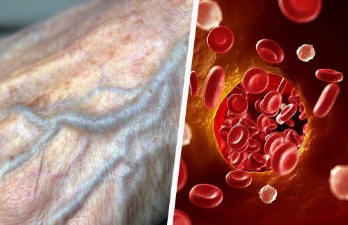 Krążenie krwi - w jaki sposób polepszyć je naturalnie?