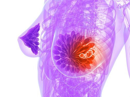 Rak piersi – zapobiegaj mu tymi produktami