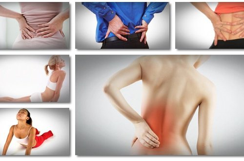 Rwa kulszowa - 8 sposobów na walkę z bólem