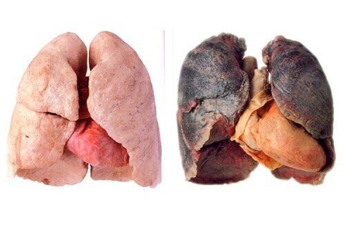 Co zrobić, aby oczyścić swoje płuca?