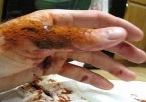 Żel na błyskawiczne tamowanie krwawienia