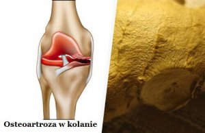 artroza tretmana masaže koljena)