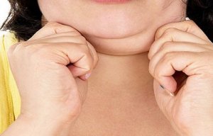 Jak zlikwidować podwójny podbródek? – 3 sposoby