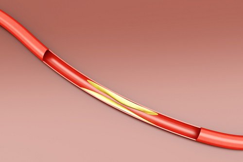 Cholesterol i zdrowie