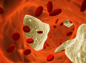 Cholesterol — 7 mitów, które powinieneś znać!