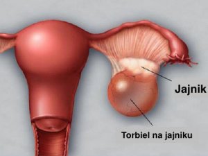 Jajniki — czynniki, które mogą im zaszkodzić