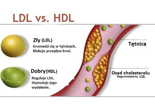 Cholesterol zły i dobry