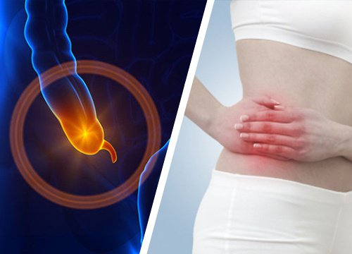 Zapalenie wyrostka – Rozpoznaj symptomy! Zapalenie wyrostka – Rozpoznaj symptomy!