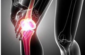 Jak leczyć zapalenie ścięgna – domowe sposoby