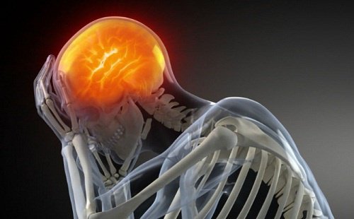 Szkielet i ból głowy
