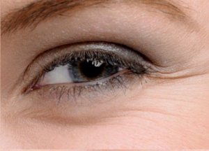 Piękne oczy – 5 domowych sposobów