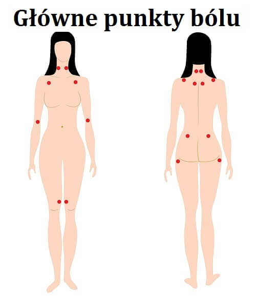Zobrazowane punkty bólu