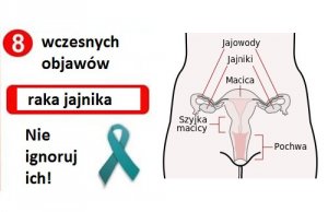 Rak jajnika: 8 wczesnych objawów