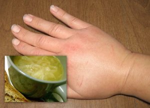 Dieta diuretyczna na zatrzymywanie wody w organizmie