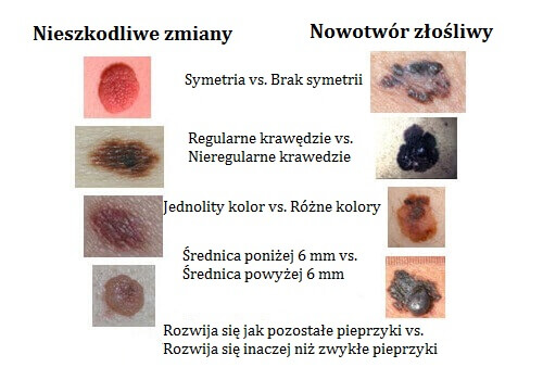 Zmiany skórne
