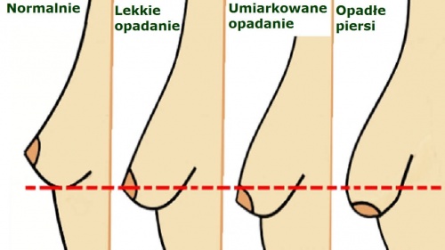 Nawyki powodujące opadanie piersi – unikaj ich! Nawyki powodujące opadanie piersi – unikaj ich!