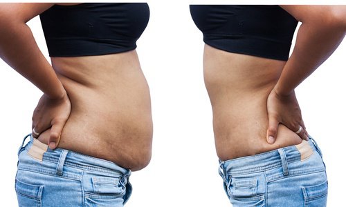 Tłuszcz na brzuchu - dlaczego się odkłada?