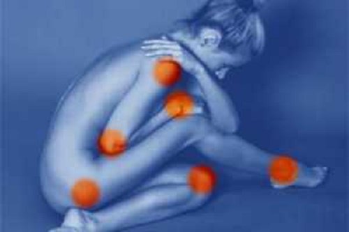 Bolesna fibromialgia