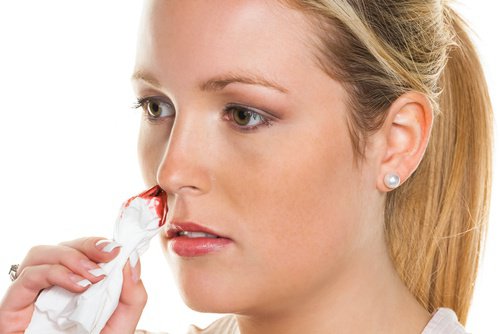 Krwawienie z nosa - naturalne środki zaradcze