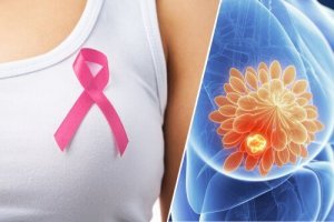 Rak piersi - 10 ostrzegawczych sygnałów