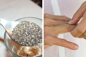 Artretyzm - jak złagodzić jego objawy