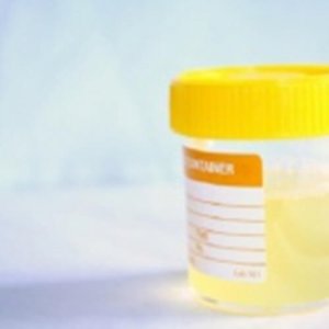 Infekcje układu moczowego - Domowe leczenie