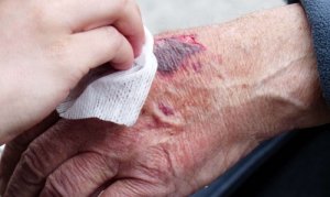 Błędy przy udzielaniu pierwszej pomocy