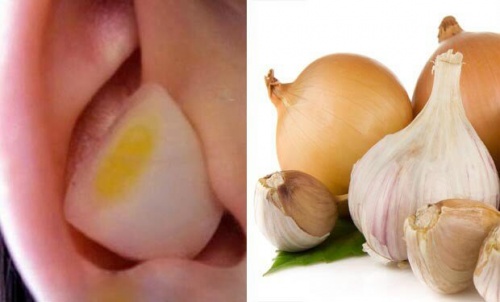Właściwości czosnku i cebuli dla ucha? Same korzyści