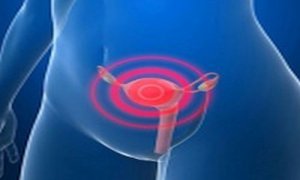 Rak szyjki macicy – Znaki ostrzegawcze