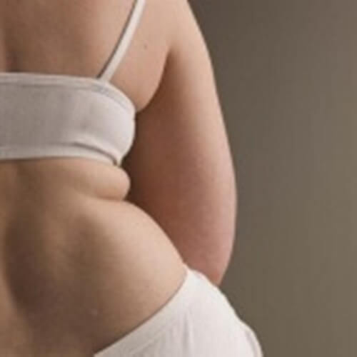 Tkanka tłuszczowa na plecach - Kilka ćwiczeń