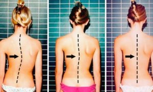 Ból w plecach? – ćwiczenia przyniosą ulgę