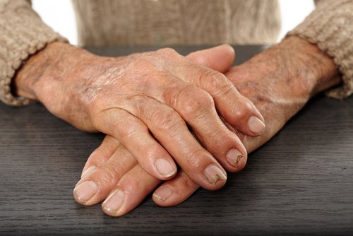 Reumatyzm – wylecz go i odzyskaj zdrowie!