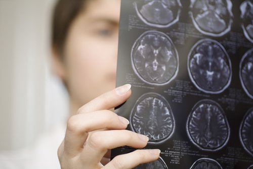 Zdjęcie rentgenowskie, a choroba Parkinsona