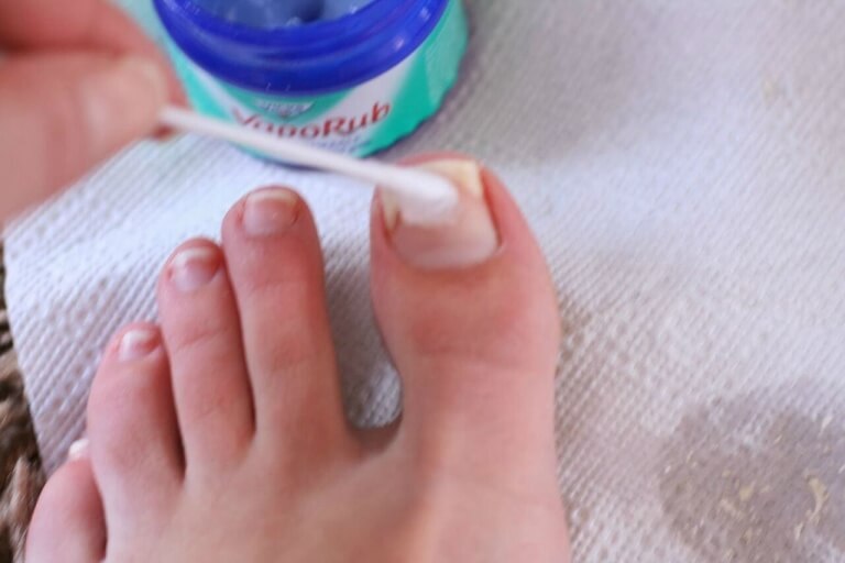 Maść Vicks Vaporub na grzybicę paznokci
