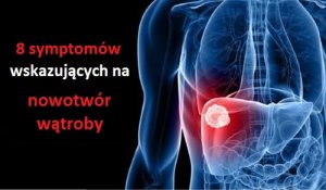 Rak wątroby - 8 symptomów