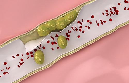 Detoks tętnic - 9 produktów, które powinieneś jeść