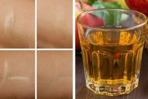 Naturalny tonik odmładzający - perfekcyjna skóra bez wysiłku