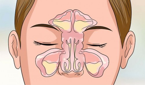 6 błyskawicznych sposobów na zatkany nos