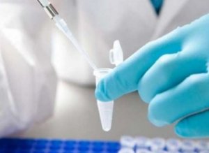 Guzy mózgu będą wykrywane dzięki płynnej biopsji