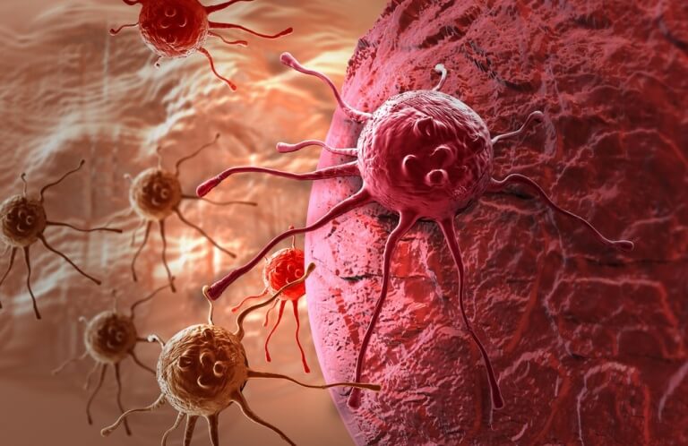 Komórki nowotworowe