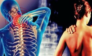 Zespół szyjno-barkowy - ból promieniujący do ramion
