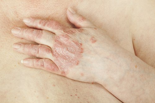Choroby skóry — co należy o nich wiedzieć?