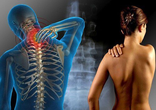 Fibromialgia - co powinieneś o niej wiedzieć?